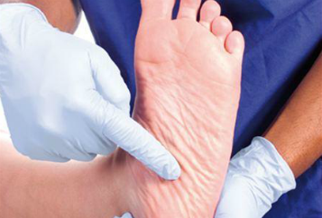 Diabetic Foot Care - Ulcers